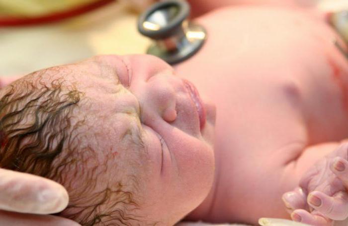 Silvermana skala un Apgar skala: novērtē jaundzimušo veselību
